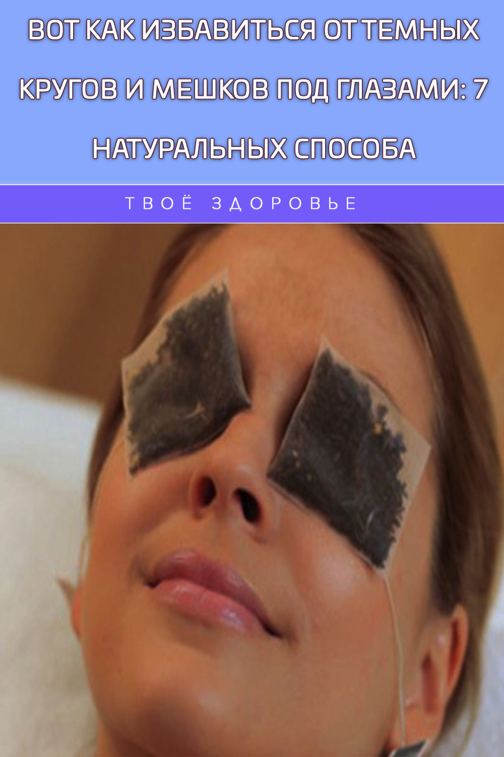 Вот как избавиться от темных кругов и мешков под глазами: 7 натуральных способа