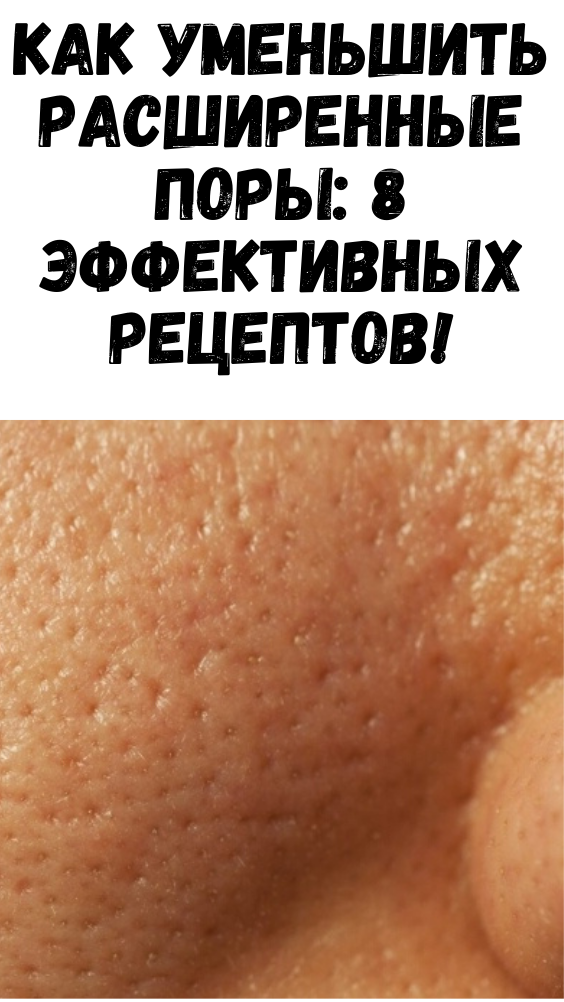 Как уменьшить расширенные поры: 8 эффективных рецептов!