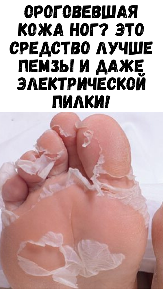 Ороговевшая кожа ног? это средство лучше пемзы и даже электрической пилки!