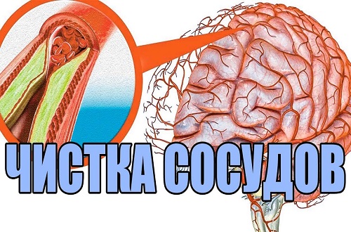 3 несложных рецепта народной медицины для сосудов головного мозга