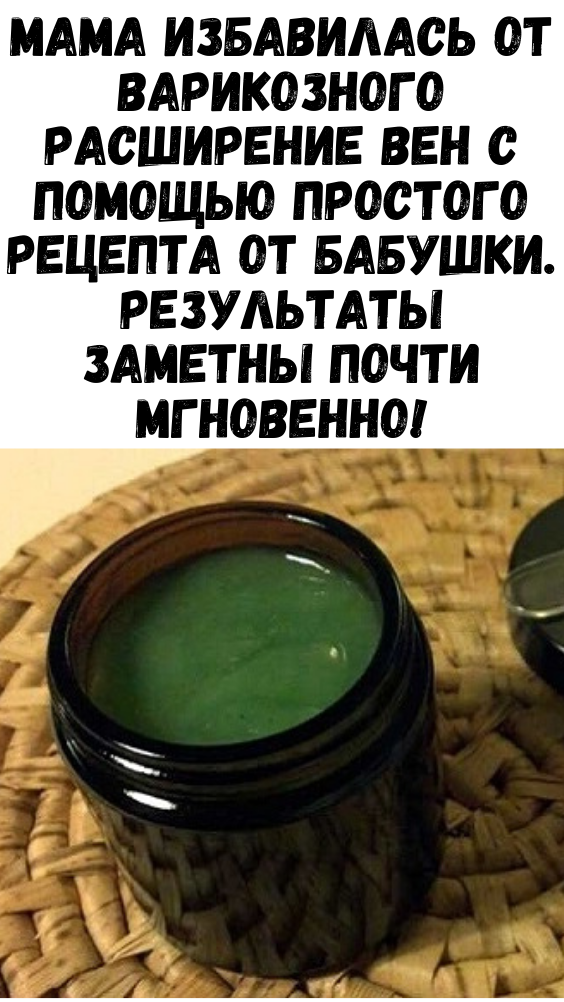 Мама избавилась от варикозного расширение вен с помощью простого рецепта от бабушки. Результаты заметны почти мгновенно!