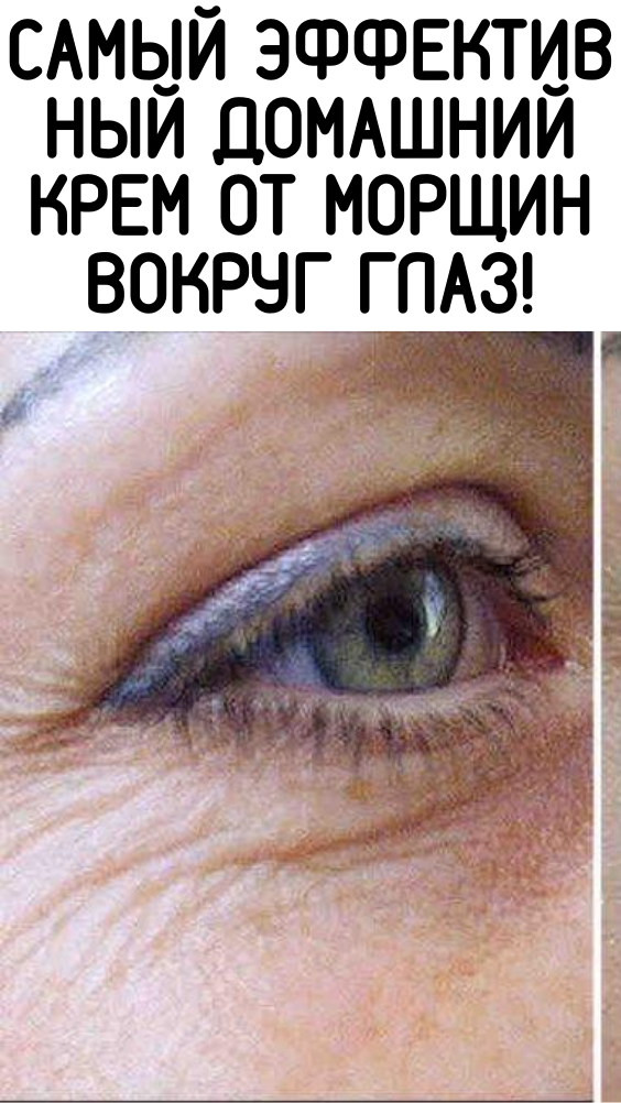 Самый эффективный домашний крем от морщин вокруг глаз!