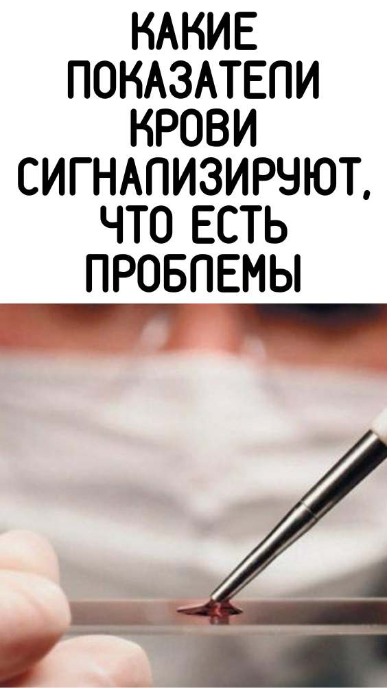 Какие показатели крови сигнализируют, что есть проблемы
