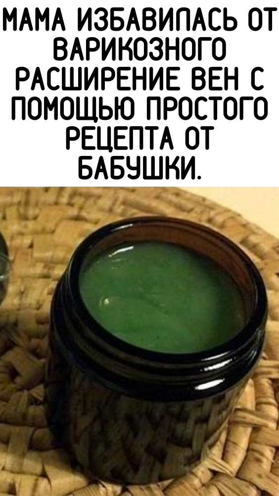 Мама избавилась от варикозного расширение вен с помощью простого рецепта от бабушки.