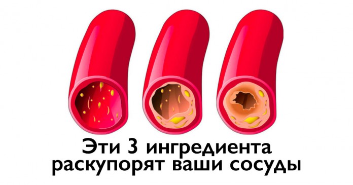 Как очистить ваши сосуды с помощью всего 3-х ингредиентов Как очистить ваши сосуды с помощью всего 3-х ингредиентов