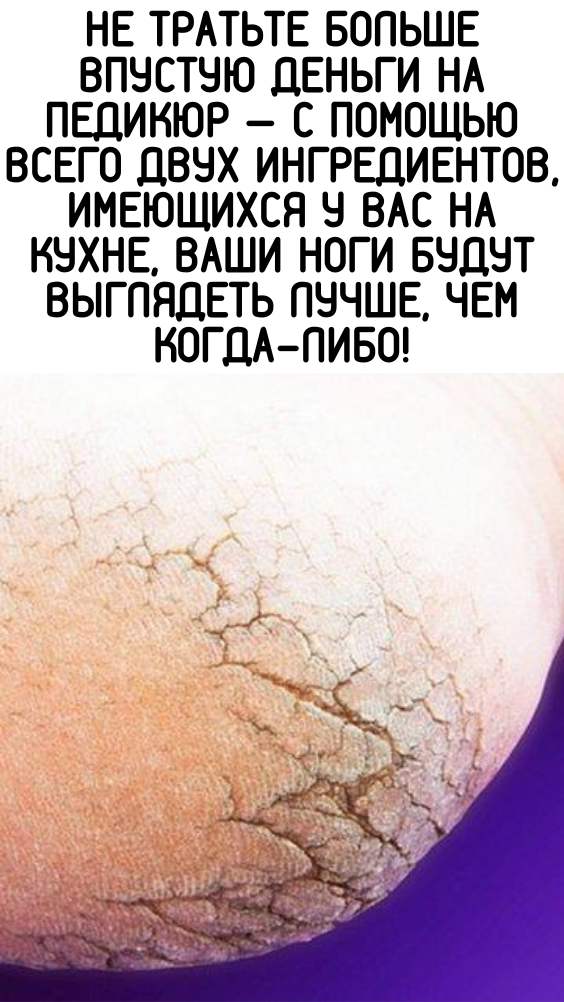 Не тратьте больше впустую деньги на педикюр — с помощью всего двух ингредиентов, имеющихся у вас на кухне, ваши ноги будут выглядеть лучше, чем когда-либо!