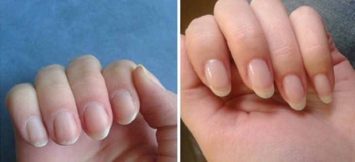 Как быстро отрастить ногти, которые никогда не сломаются: поможет простое средство из 4 компонентов! Как быстро отрастить ногти, которые никогда не сломаются: поможет простое средство из 4 компонентов!
