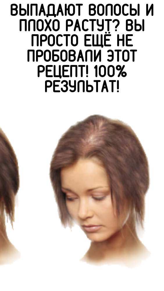 Выпадают волосы и плохо растут? Вы просто ещё не пробовали этот рецепт! 100% результат!