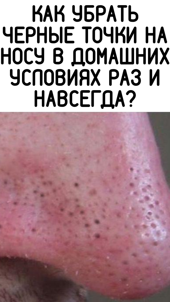 Как убрать черные точки на носу в домашних условиях раз и навсегда?