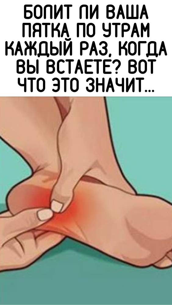 Болит ли Ваша пятка по утрам каждый раз, когда Вы встаете? Вот что это значит…