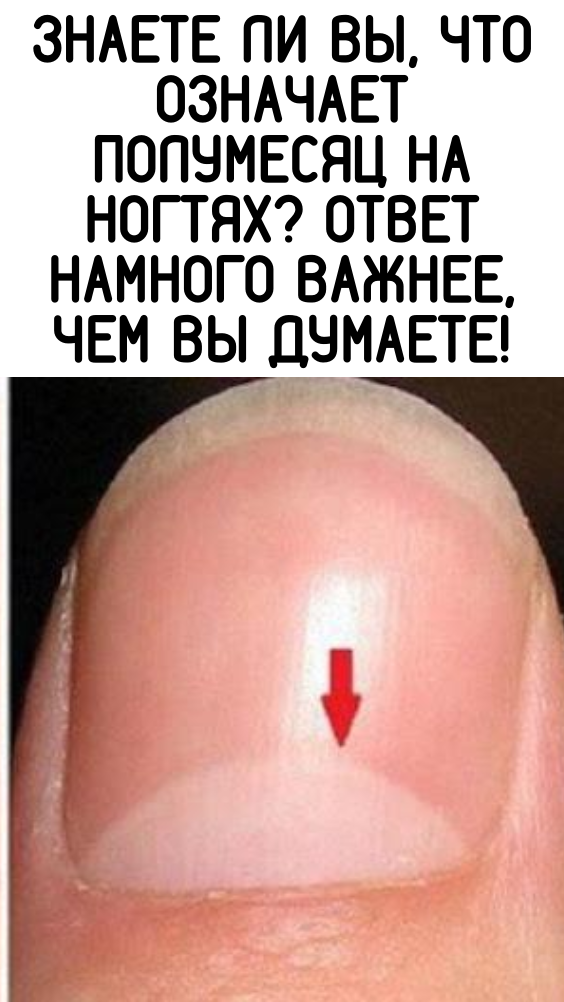 Знаете ли вы, что означает ПОЛУМЕСЯЦ НА НОГТЯХ? Ответ намного ВАЖНЕЕ, чем вы думаете!