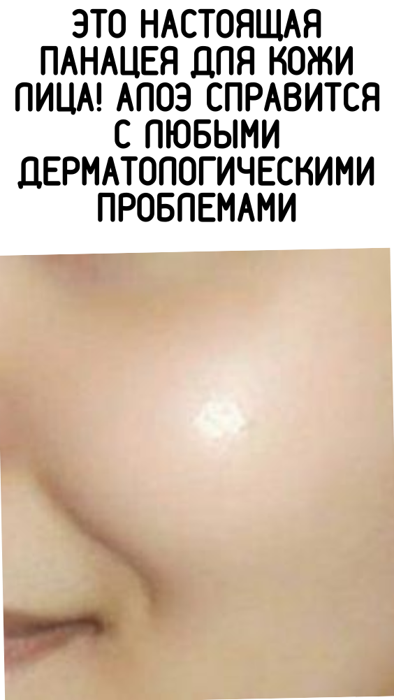 Это настоящая панацея для кожи лица! Алоэ справится с любыми дерматологическими проблемами