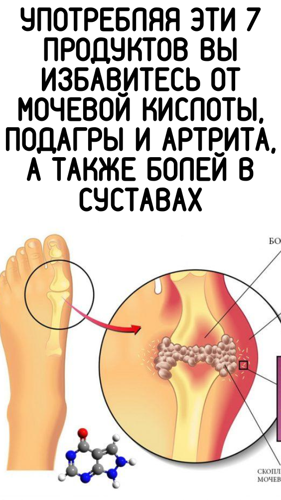 Употребляя эти 7 продуктов вы избавитесь от мочевой кислоты, подагры и артрита, а также болей в суставах