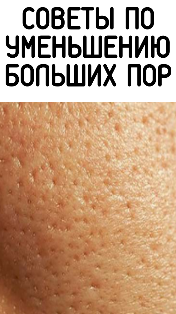 Советы по уменьшению больших пор