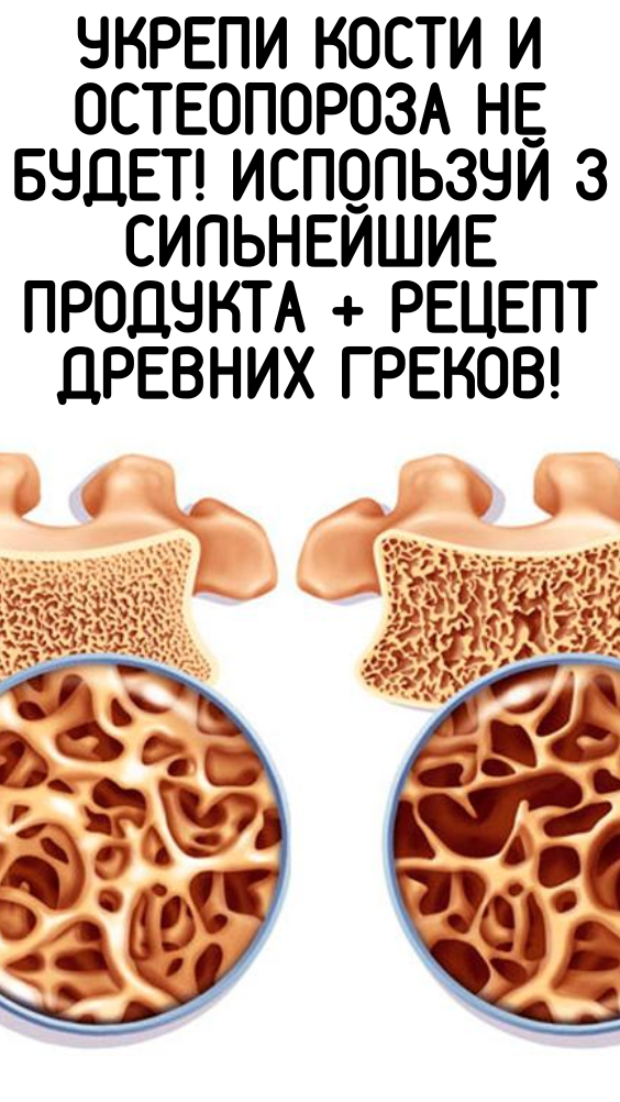 Укрепи кости и остеопороза не будет! Используй 3 сильнейшие продукта + рецепт древних греков!