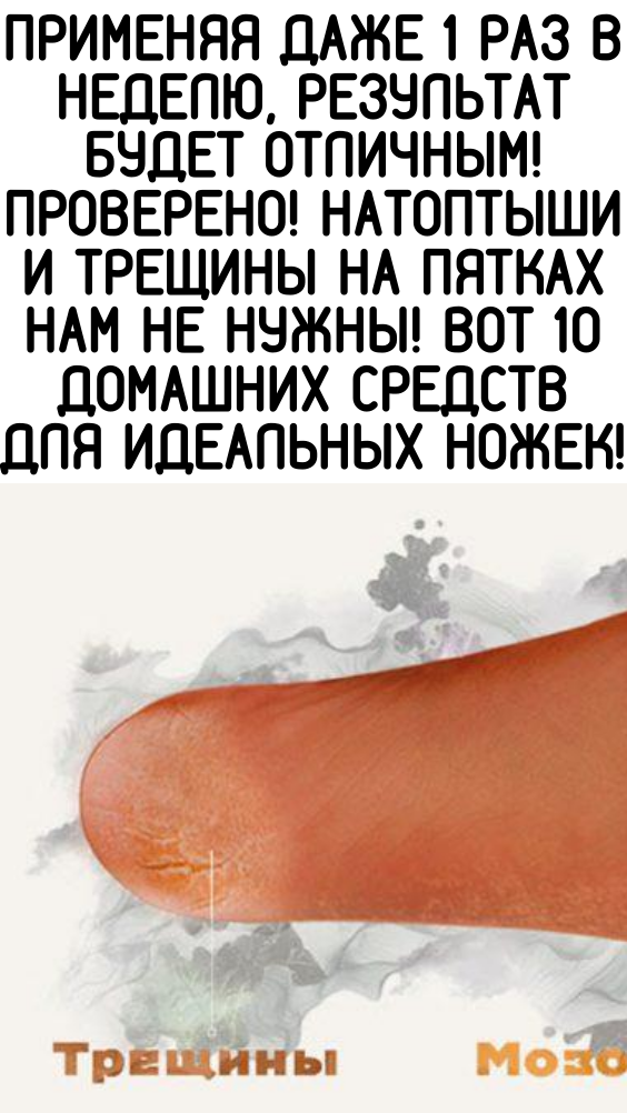 Применяя даже 1 раз в неделю, результат будет отличным! Проверено! Натоптыши и трещины на пятках нам не нужны! Вот 10 домашних средств для идеальных ножек!