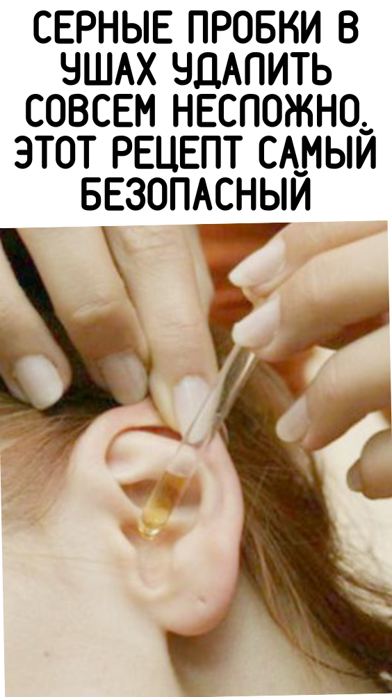 СЕРНЫЕ ПРОБКИ В УШАХ УДАЛИТЬ СОВСЕМ НЕСЛОЖНО. ЭТОТ РЕЦЕПТ САМЫЙ БЕЗОПАСНЫЙ