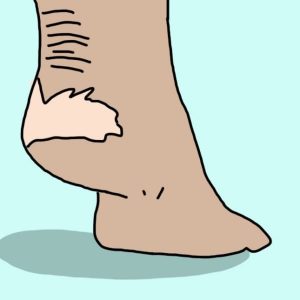 Лечим болезни ног ополаскивателем для рта. Невероятно, но работает! Лечим болезни ног ополаскивателем для рта. Невероятно, но работает!