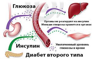 Черновик