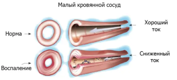 Основные причины хронической усталости