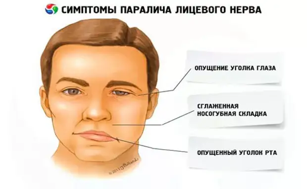 Лицо перекосило…