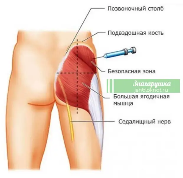 Как правильно делать инъекции. Сохраните себе эту важную информацию