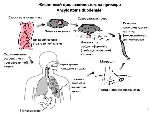 Скрытые симптомы, которые могут появиться у человека, зараженного глистами