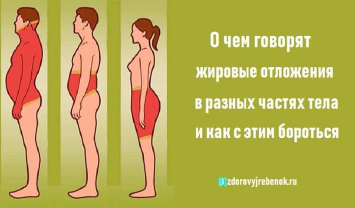 О чем говорят жировые отложения в разных частях тела и как с этим бороться О чем говорят жировые отложения в разных частях тела и как с этим бороться