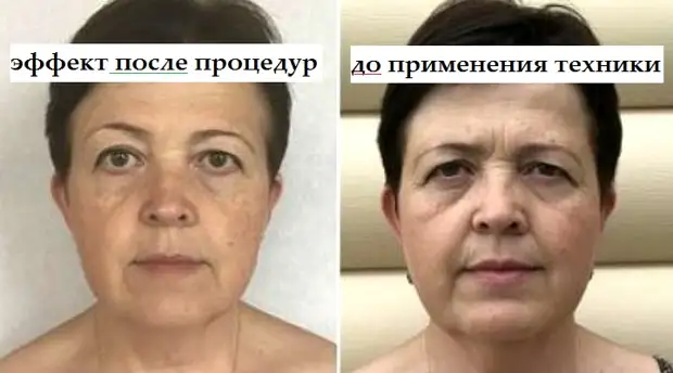 Подтянуть овал лица и выровнять осанку: просто ЛЕЖИМ по 5 мин в день по японской методике
