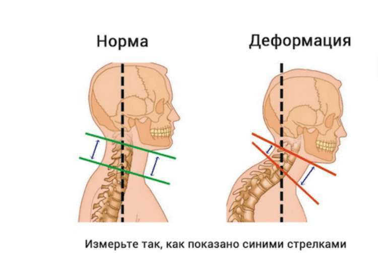 Почему со временем меняется овал лица