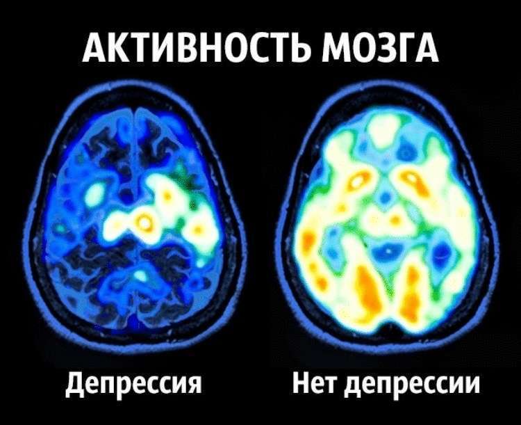 Счастье по науке: как приучить мозг вырабатывать гормоны счастья Счастье по науке: как приучить мозг вырабатывать гормоны счастья