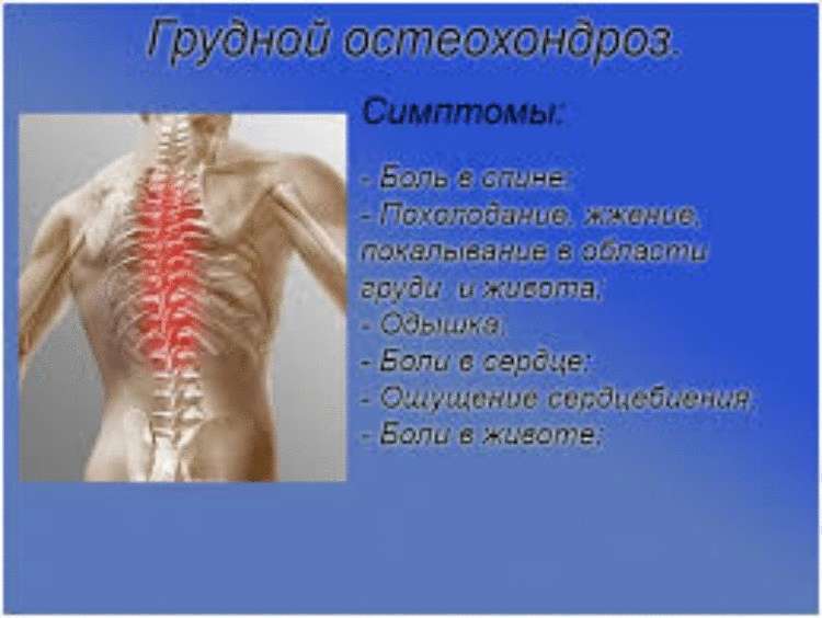 Влияние шейного остеохондроза на здоровье