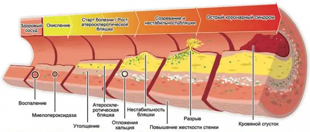 Факты о холестерине, о которых мало кто знает