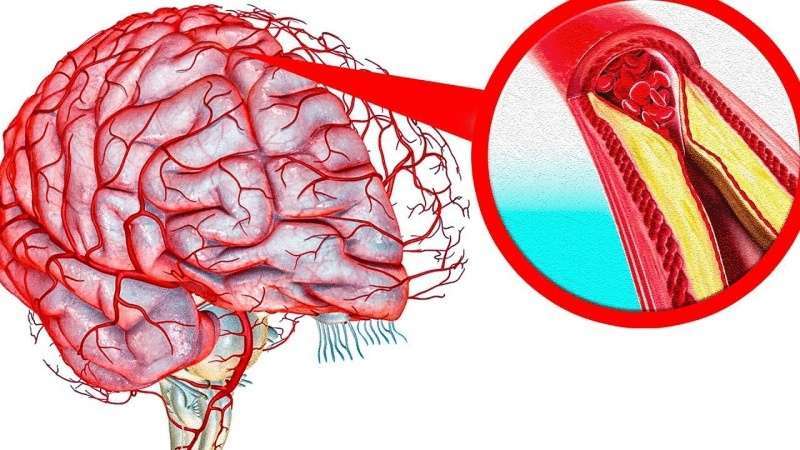Средства, очищающие сосуды Средства, очищающие сосуды
