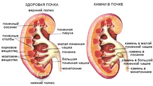 Основные причины цистита и урологических проблем, о которых вы могли не знать