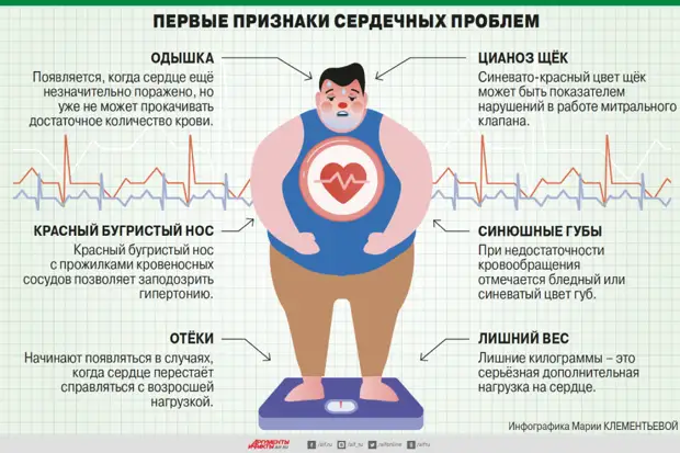 3 упражнения от инфаркта