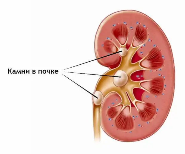 Признаки урологических заболеваний