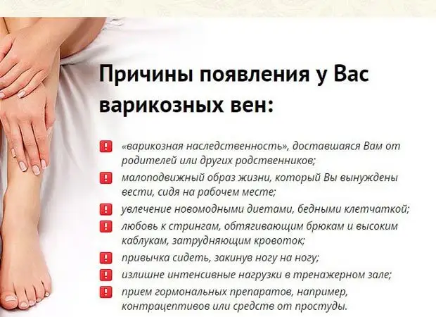 Как распознать варикоз и остановить болезнь на ранней стадии