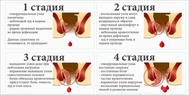 Болезнь, о которой не принято говорить