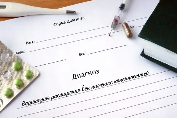 Диагноз: варикозное расширение вен
