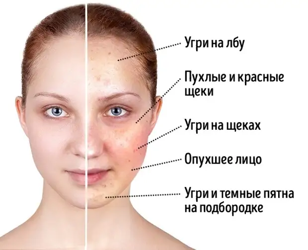 Продукты, которые портят внешность