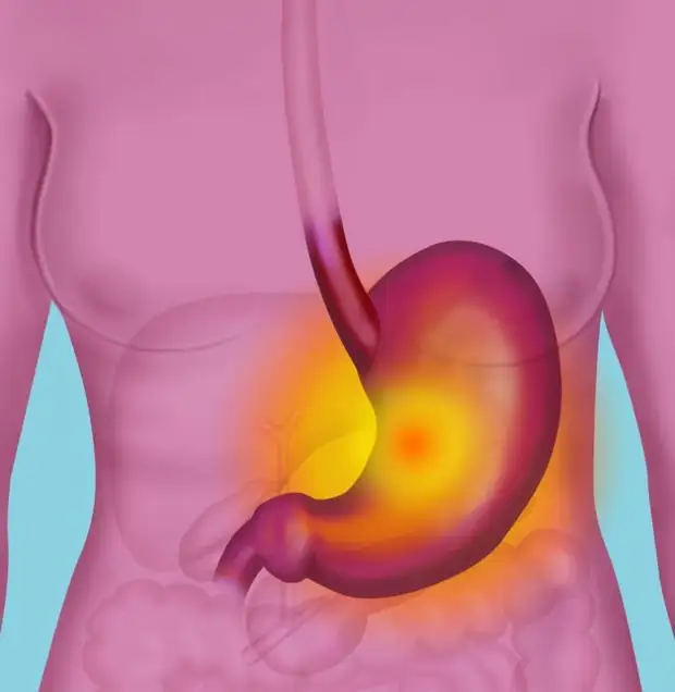 9 продуктов помогут облегчить симптомы гастрита