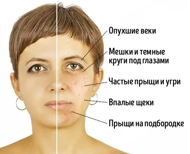 Продукты, которые портят внешность