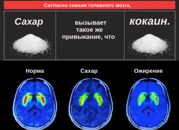 17 вредных свойств сахара, разрушающих здоровье человека