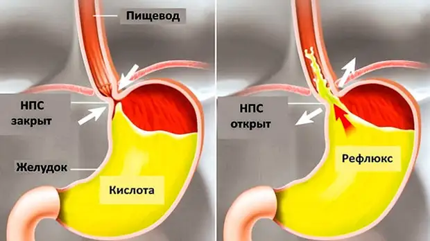 Как избавиться от лишнего веса и жира