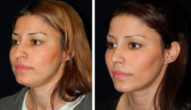 Упражнения, которые отодвинут старение