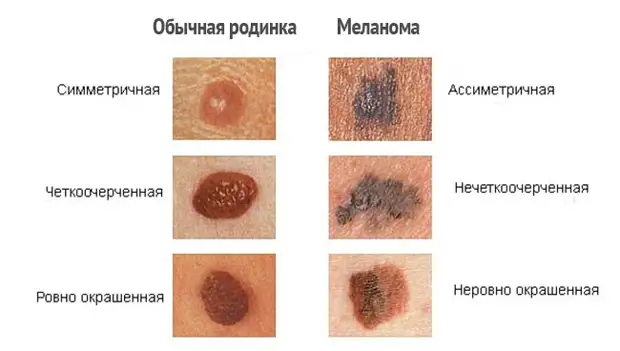 Список самых опасных и незаметных болезней