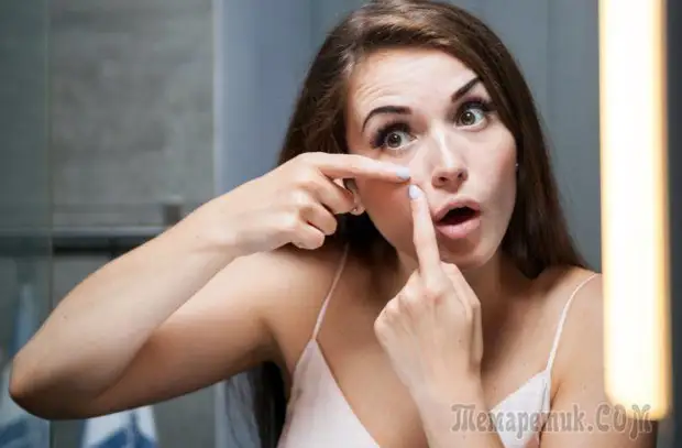 Как избавиться от чёрных точек на лице