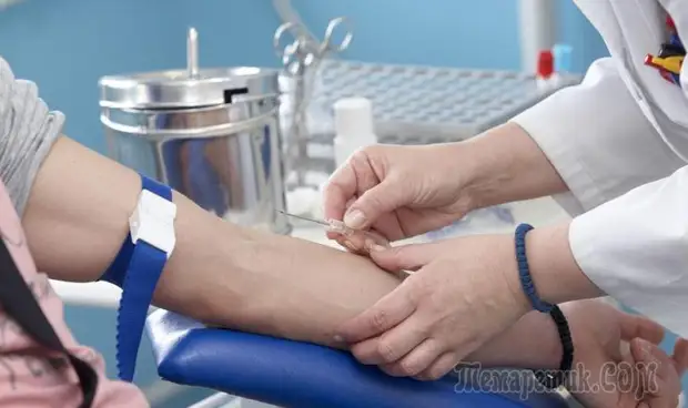 Зачем и как нужно выводить мочевую кислоту из организма