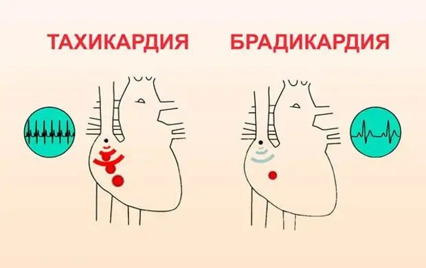 Почему нужно знать свои показатели пульса и давления
